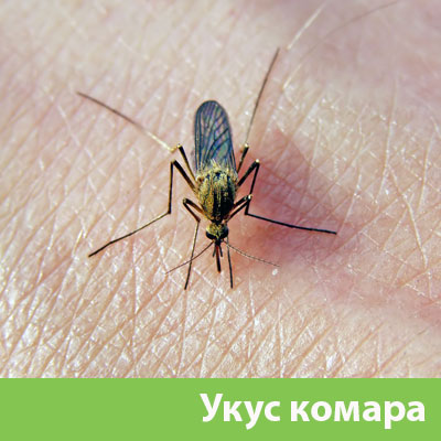 Укусы комаров в Новом Уренгое